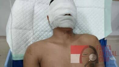 Gencar Perlakuan Kekerasan Terhadap Pers Di Sumut, Apa Tanggapan Edy Ramayadi?