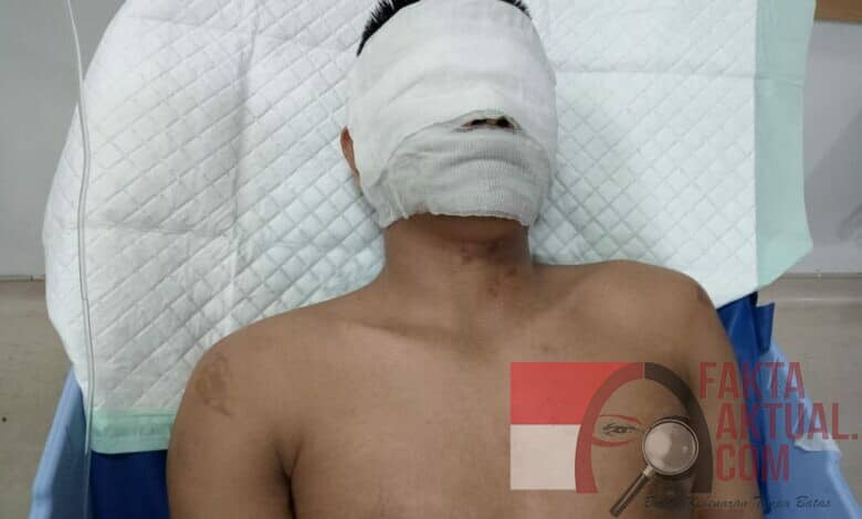 Photo of Gencar Perlakuan Kekerasan Terhadap Pers Di Sumut, Apa Tanggapan Edy Ramayadi?